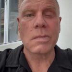 Bývalý kapitán Manchestru City Andy Morrison otvoril svoj boj s ničivým neurologickým stavom