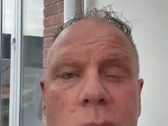 Bývalý kapitán Man City (55) začal bojovať o zdravie po tom, čo mu diagnostikovali zničujúci neurologický stav Bývalý kapitán Manchestru City Andy Morrison otvoril svoj boj s ničivým neurologickým stavom