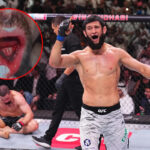 Bývalý šampión, ktorému Khamzat vytrhol zuby, predpovedá UFC 328 – a fanúšikom Stricklandu sa to nebude páčiť