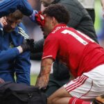 Forest sa neskoro rozhodol o Gibbs-White fitness pre Villa Europa semi