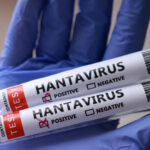 Máme sa obávať vypuknutia hantavírusu? | Správy o zdraví