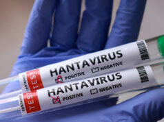 Máme sa obávať vypuknutia hantavírusu? | Správy o zdraví Máme sa obávať vypuknutia hantavírusu? | Správy o zdraví