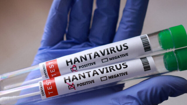 Máme sa obávať vypuknutia hantavírusu? | Správy o zdraví
