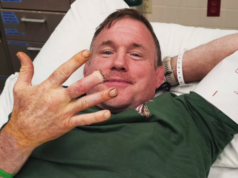 Matt Hughes si po krvavej nehode musel amputovať prst Matt Hughes si po krvavej nehode musel amputovať prst