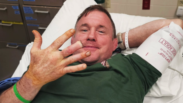 Matt Hughes si po krvavej nehode musel amputovať prst
