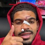 Nottingham Forest skúma možnosť, že by si Morgan Gibbs-White nasadil masku na štvrtkový obrovský zápas Európskej ligy s Aston Villou.