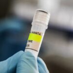 Spojené kráľovstvo identifikovalo nový podozrivý prípad hantavírusu na vzdialenom ostrove | Správy o zdraví