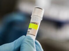 Spojené kráľovstvo identifikovalo nový podozrivý prípad hantavírusu na vzdialenom ostrove | Správy o zdraví Spojené kráľovstvo identifikovalo nový podozrivý prípad hantavírusu na vzdialenom ostrove | Správy o zdraví