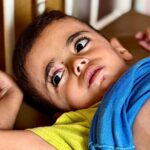 Vyrážky podobné popáleninám a hlad: deti v Gaze čelia kríze kožných chorôb | Správy o konflikte medzi Izraelom a Palestínou
