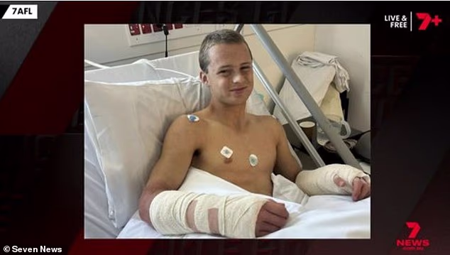 Jack Dalton bol obvinený zo zlomeniny oboch zápästí pri nehode v posilňovni v marci 2025.