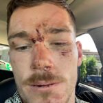 Šlapku Canberra Raiders Toma Starlinga údajne napadla polícia a udierala ho päsťami do hlavy, kým nezomrel počas incidentu v decembri 2020 v bare NSW.