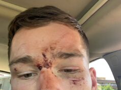 Policajt odhaľuje, prečo zapískal na svojich kolegov dôstojníkov po tom, čo údajne vyhnali hviezdu NRL Toma Starlinga do bezvedomia Šlapku Canberra Raiders Toma Starlinga údajne napadla polícia a udierala ho päsťami do hlavy, kým nezomrel počas incidentu v decembri 2020 v bare NSW.