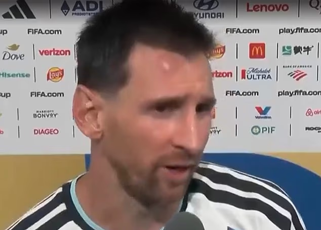 Lionel Messi odišiel z víťaza Argentíny na Kapverdách s modrinou na čele